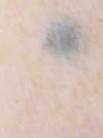 peau