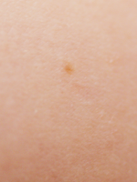 peau